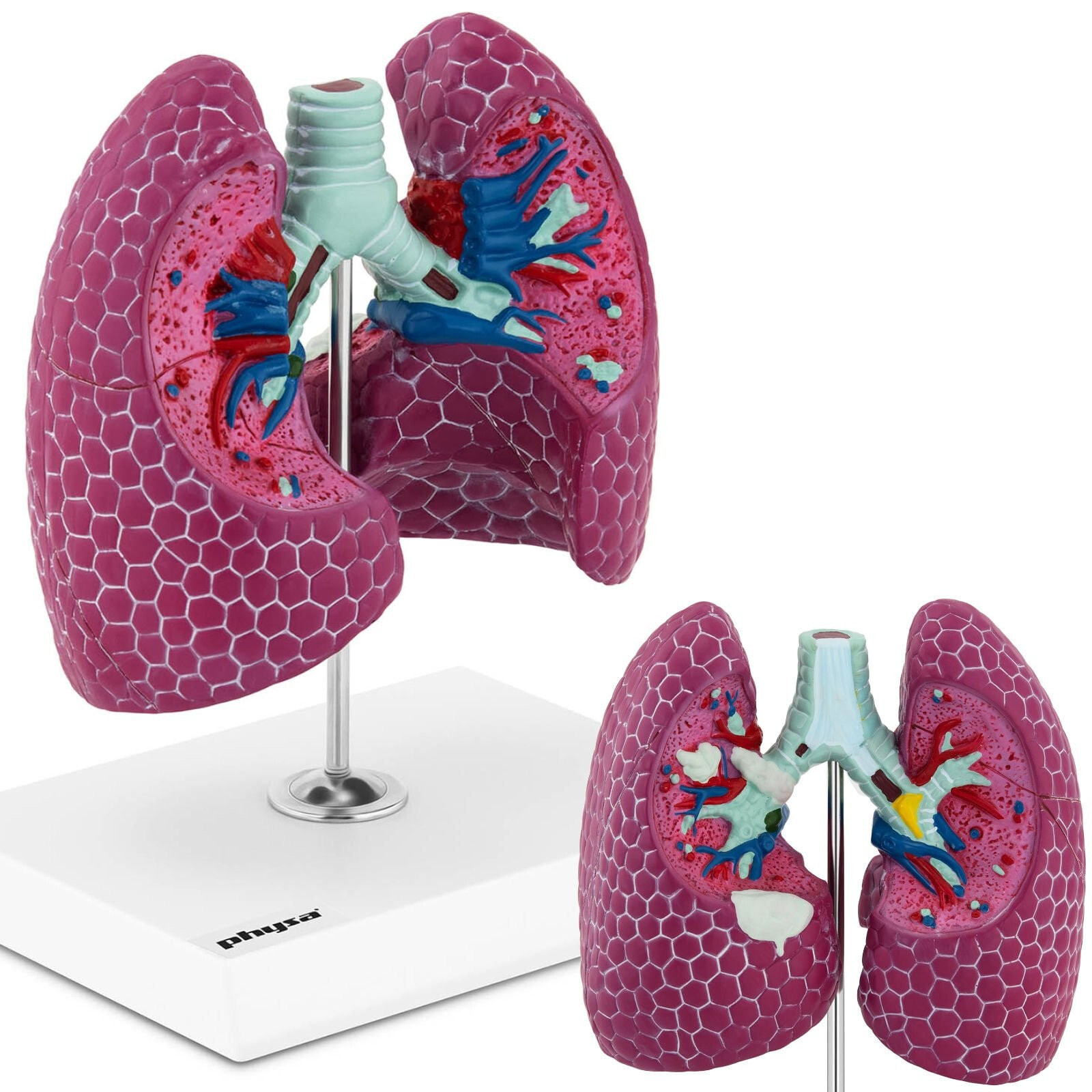 3D anatomical model of human lung with lesions