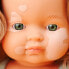 MINILAND Caucasian Dark Blonde Girl With Vitiligo 38 cm baby doll