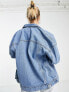 Фото #2 товара Only oversized denim jacket in medium blue