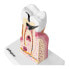 Фото #2 товара Модель анатомического больного зуба человека в масштабе 6:1 Physa