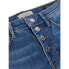 Фото #5 товара GUESS 1981 Exposed Button jeans