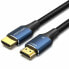 Фото #1 товара Кабель HDMI Vention ALGLG 1,5 m Синий